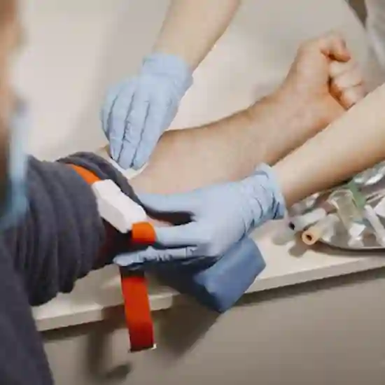 clofazimine drug test